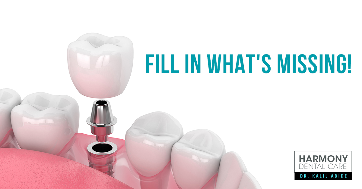 Dental Implants for Missing Molars What Patients Should Know